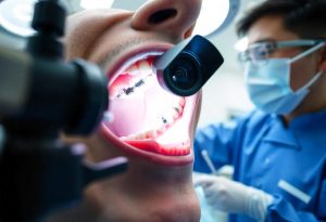 How Intraoral Cameras Help Dentists